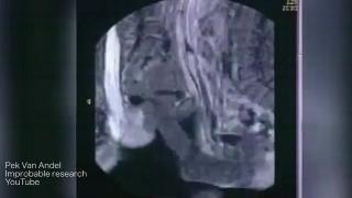 MRI scans take a look at internal organs during sex